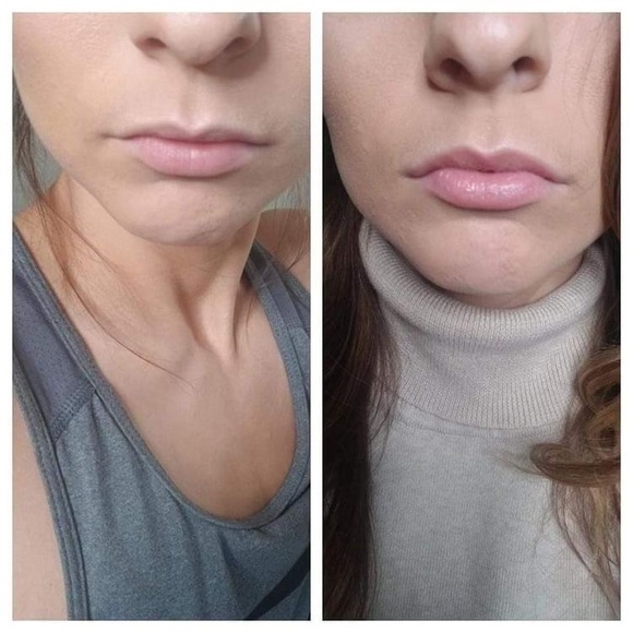 Lip plumping balm - Picture 3 of 3